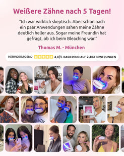 onlysmile-zahnaufhellungsset-led-sichtbar-wei-ere-z-hne-in-5-tagen-2 image 7