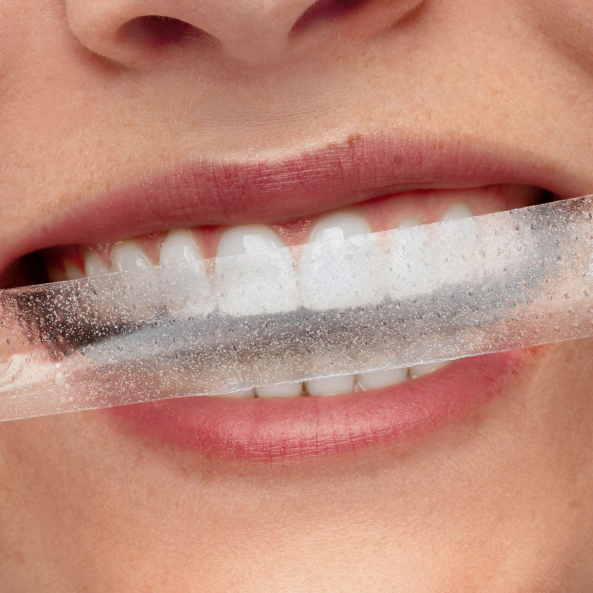 smilepen-night-whitening-strips-zahnaufhellungsstreifen-f-r-die-nacht-10x2-strip image 5