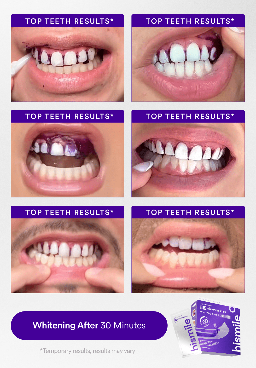 hismile-affordable-whitening-set-3-teilige-routine-mit-gratis-mundsp-lung image 3