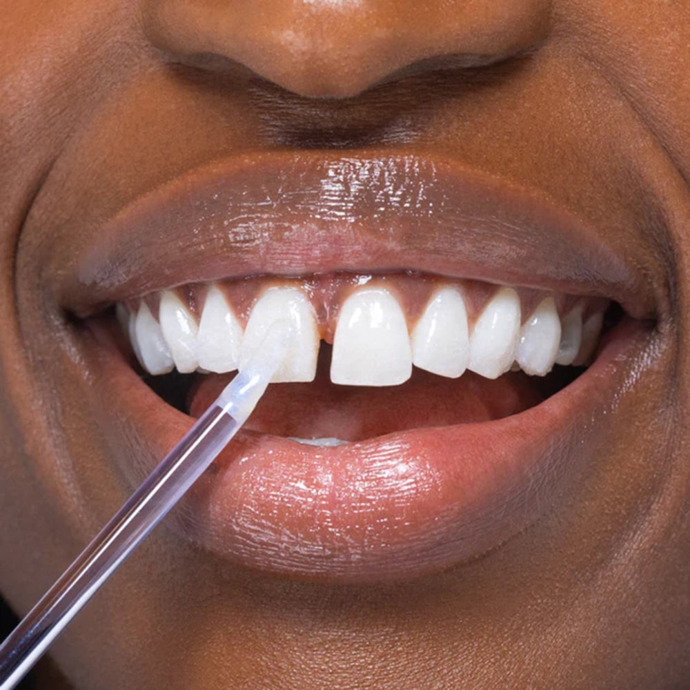 diamondsmile-bleaching-glow-stick-zahngloss-f-r-sofortigen-glanz image 4
