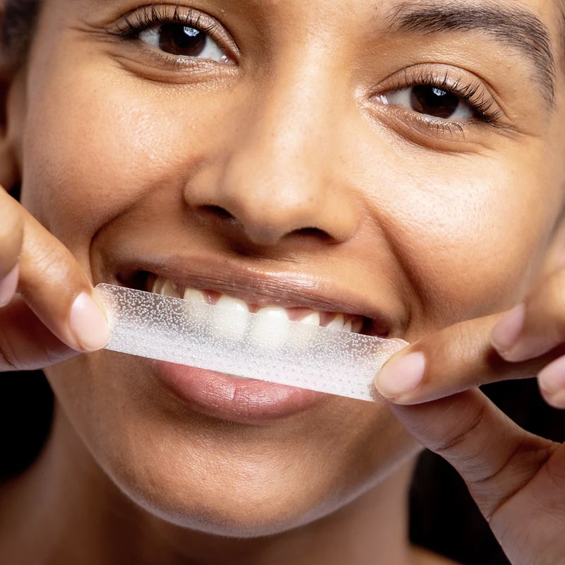 diamondsmile-zahnbleaching-pap-strips-zahnaufhellungsstreifen-f-r-zu-hause image 3