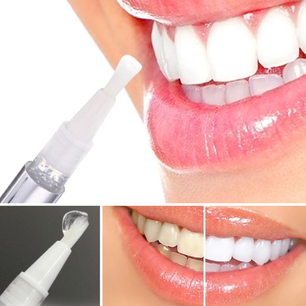 diamondsmile-zahnbleaching-stift-whitening-pen-f-r-unterwegs-mit-sofort-effekt image 5