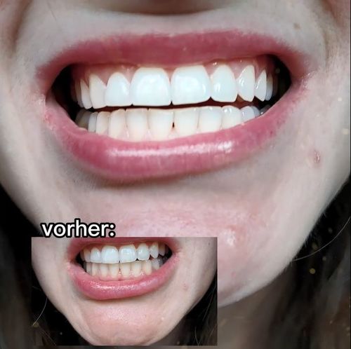 Beste Entscheidung
