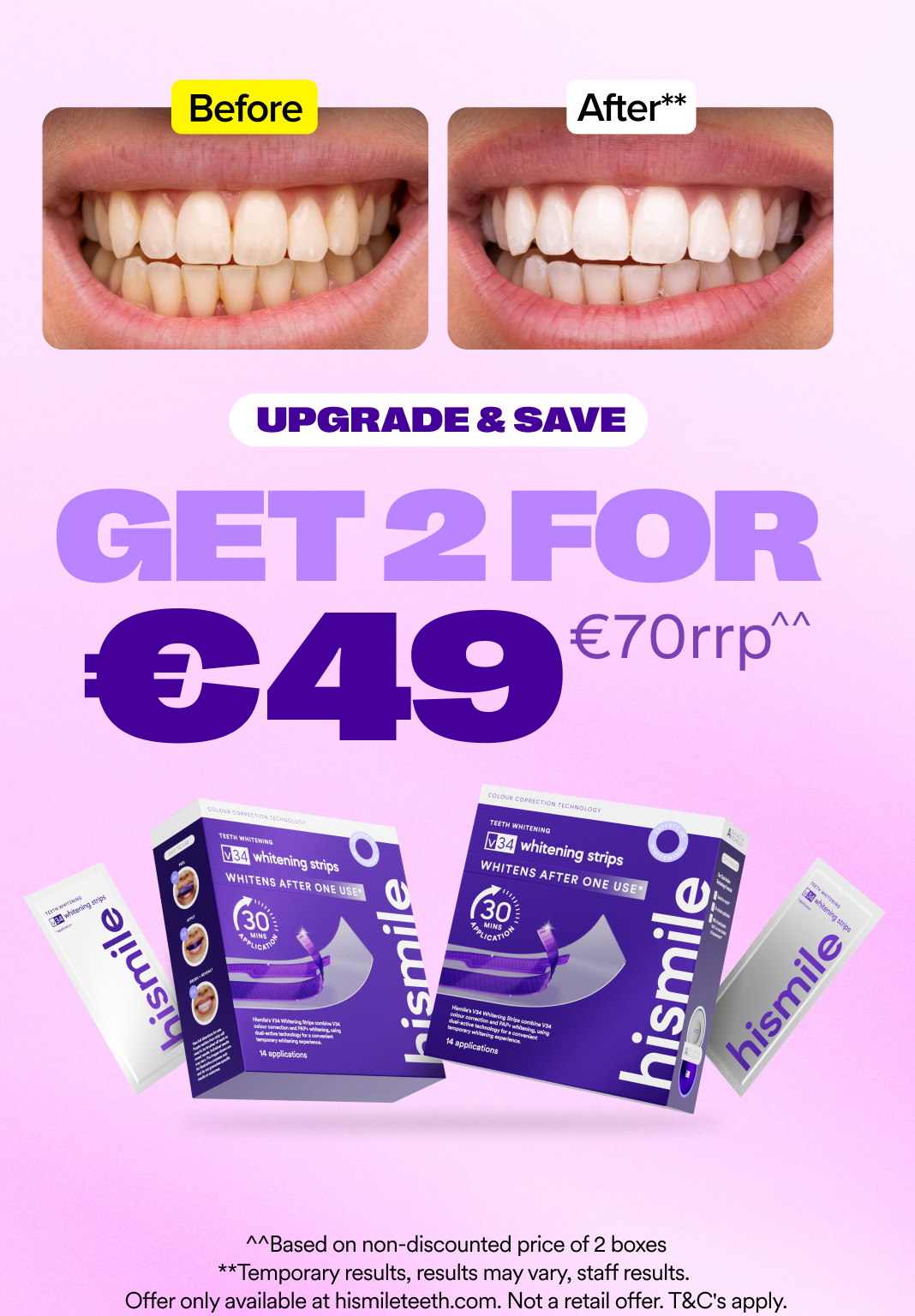 hismile-v34-whitening-strips-doppelpack-28-anwendungen image 3