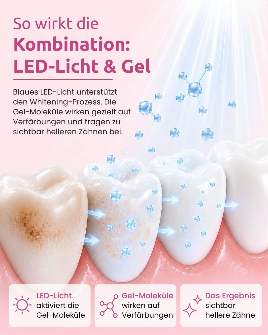 onlysmile-zahnaufhellungsset-led-sichtbar-wei-ere-z-hne-in-5-tagen image 8