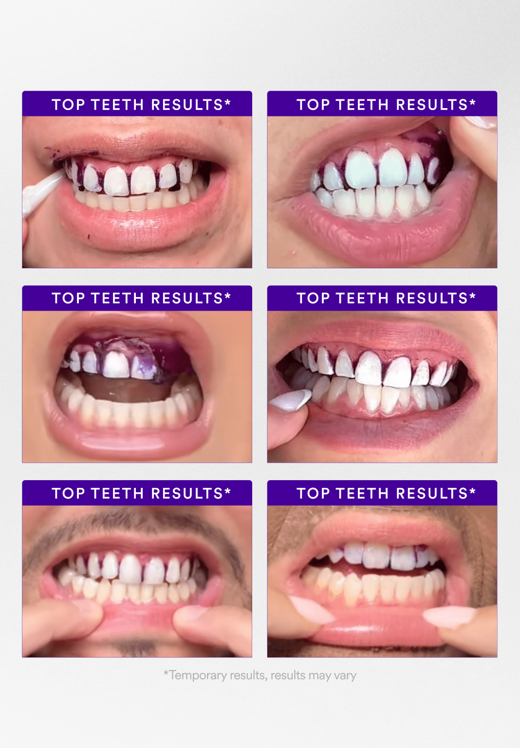 hismile-v34-whitening-strips-zahnaufhellungsstreifen-14-anwendungen image 4
