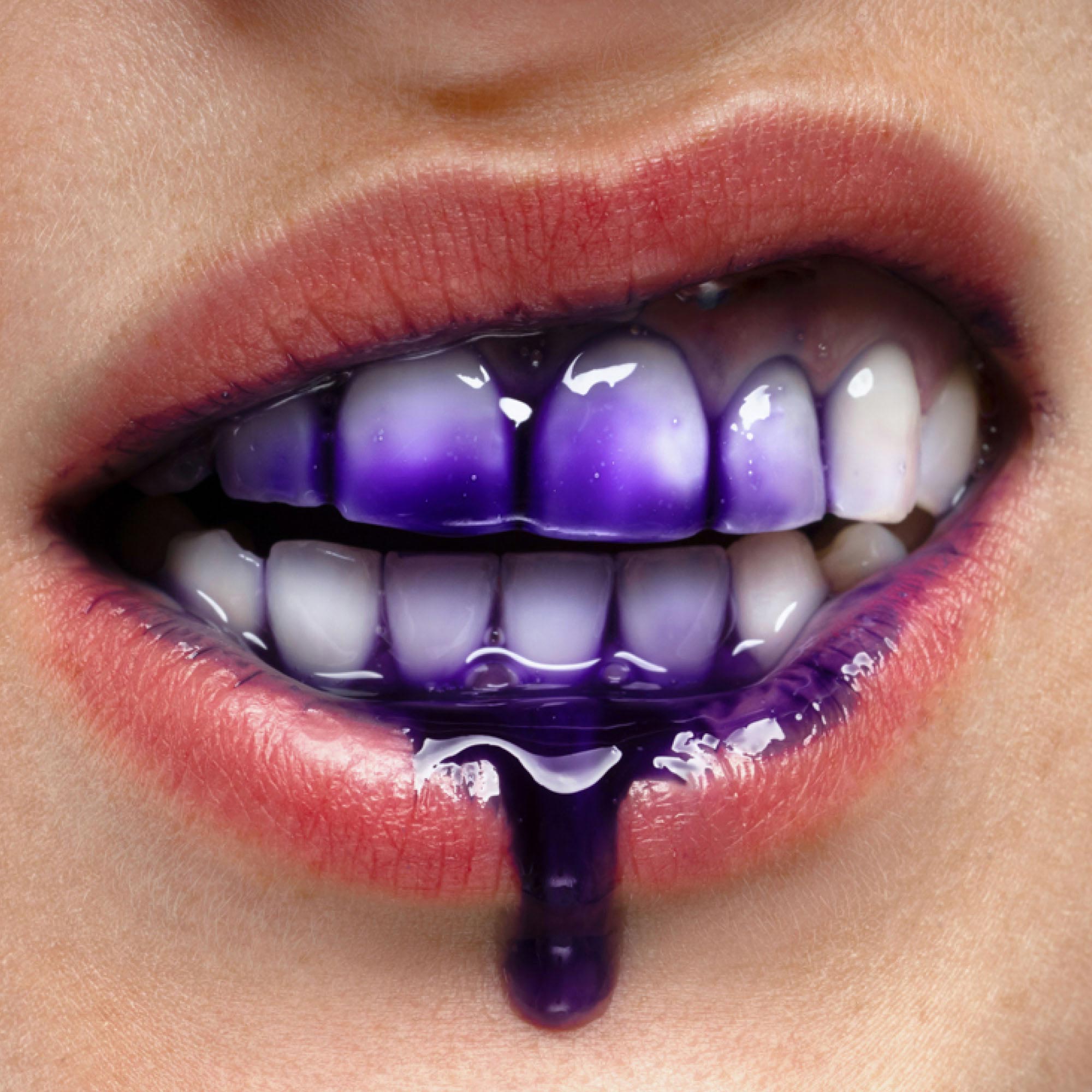 smilepen-instasmile-instant-white-serum-violettes-zahn-make-up-f-r-sofort-wei-er image 4