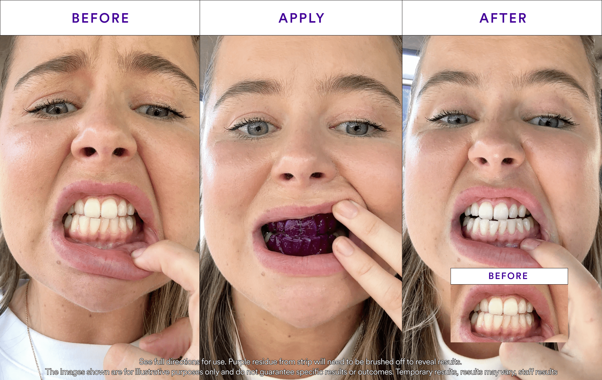 hismile-v34-whitening-strips-zahnaufhellungsstreifen-14-anwendungen image 6